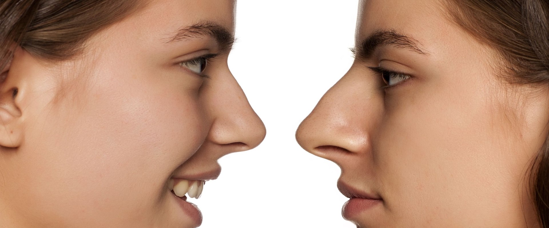 Transformative Rhinoplasty In NYC For Mind Body Wellness